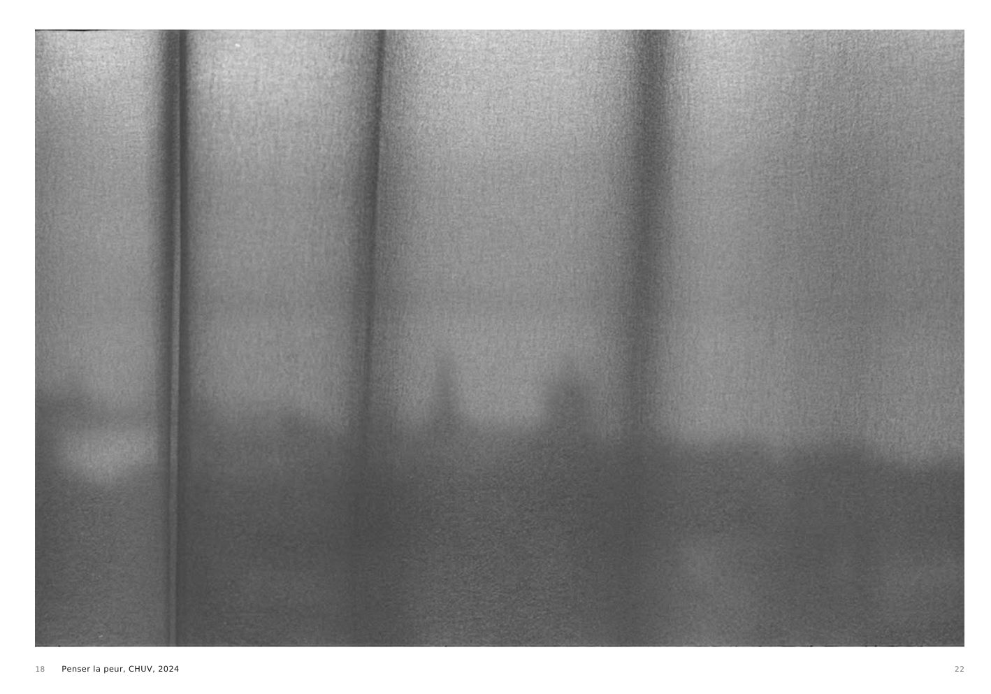 Penser la peur, CHUV, 2024, a shadow seen through a translucent hospital curtain